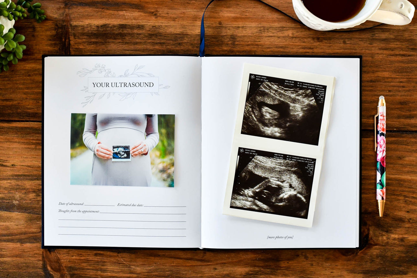 Dear Baby Pregnancy Journal