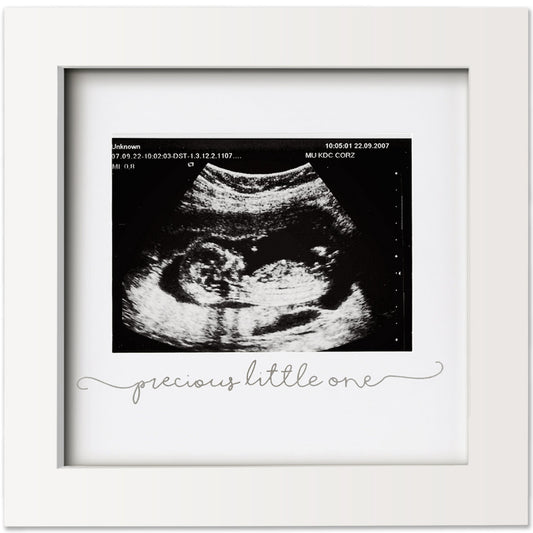 SOLO Baby Sonogram Picture Frame | Alpine White